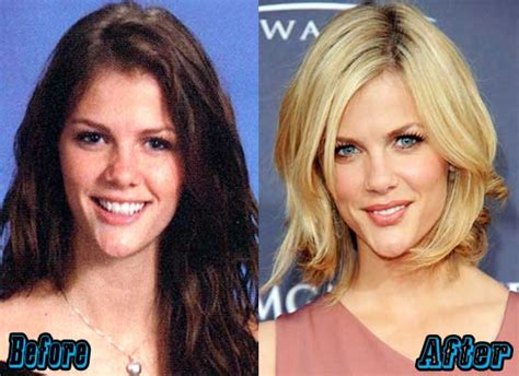 brooklyn decker leak|Brooklyn Decker Plastic Surgery Before and After Photos